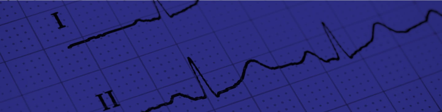 Blue scale dot grid paper with line graphs across